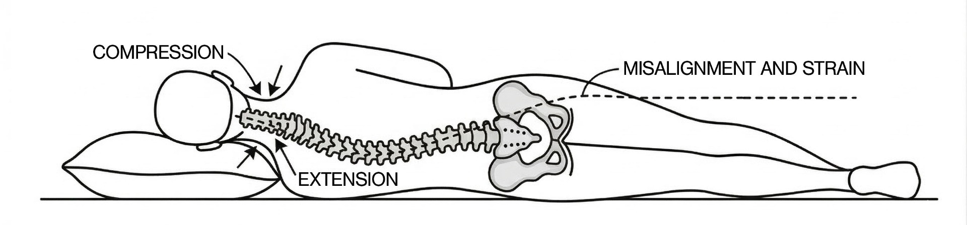 Spinal Alignment 2