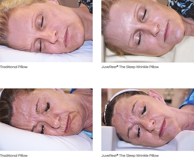 See the Difference with Juverest The Sleep Wrinkle Pillow