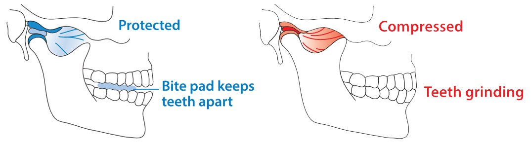 LunaGuard with packaging